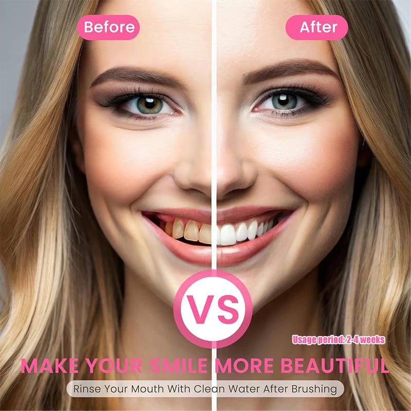 Niacinamide BrightSmile Toothpaste For a Naturally Radiant Smile